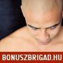 A haj tkletes illzija orvosi mikropigmentci a Hair Dr Clinic nl 149 990 rt